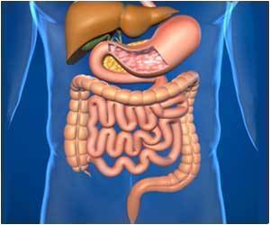 Oral Lipid Nanoparticle Drug Averts Colitis-Associated Cancer Development