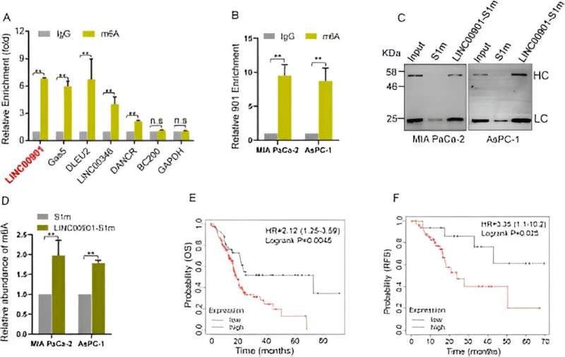 New Insights Into How RNA Modification Promotes Pancreatic Cancer