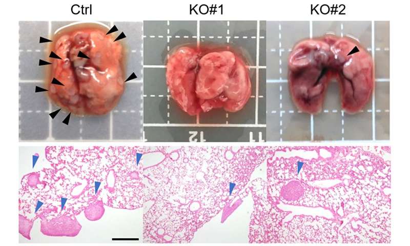 Immobilizing melanoma