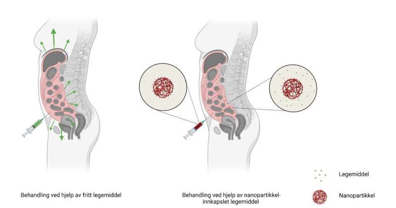 Nanotechnology can provide more effective treatment for patients with peritoneal cancer