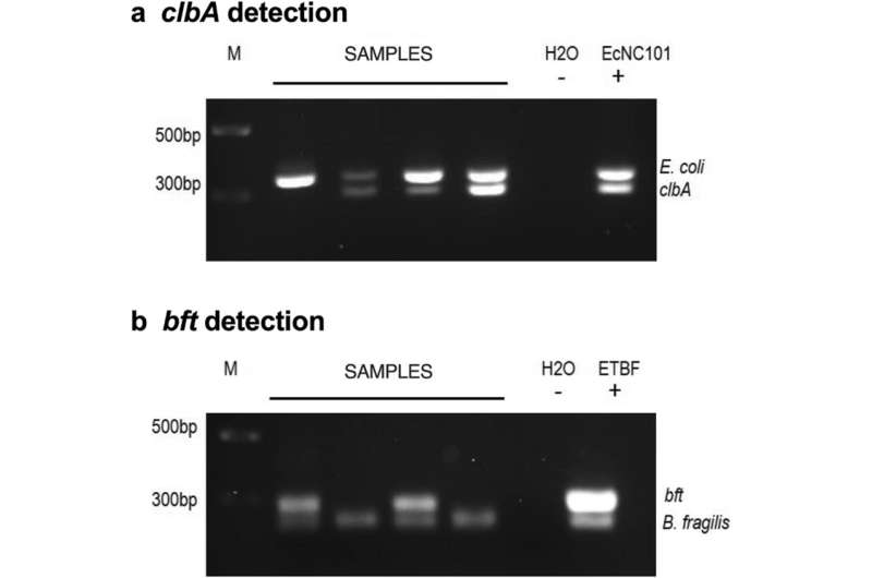 New insights into colorectal cancer and E. coli