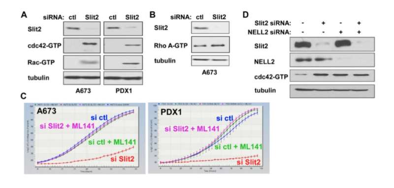 Slit2 signaling stimulates Ewing sarcoma growth 