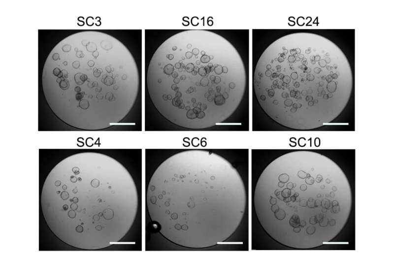 Cancer biology: Some cancer cells can lose their capability to migrate