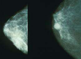 New wireless device can aid recovery of breast cancer patients