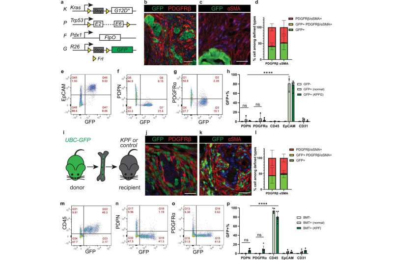 Discovery of cancer-associated fibroblast origin gives new direction for pancreatic cancer research 