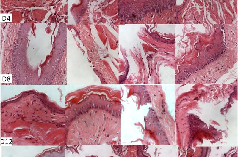 The chromatographic constitution of andiroba oil and its healing effects 