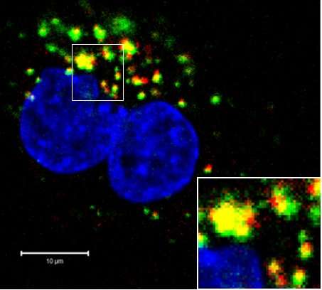 Scientists develop DNA molecule that may one day be used as 'vaccine' for prostate cancer