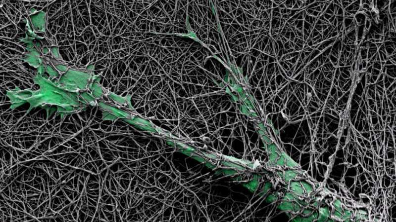 Skin cancer cells harness nerve cell gene to drill through and invade new tissues