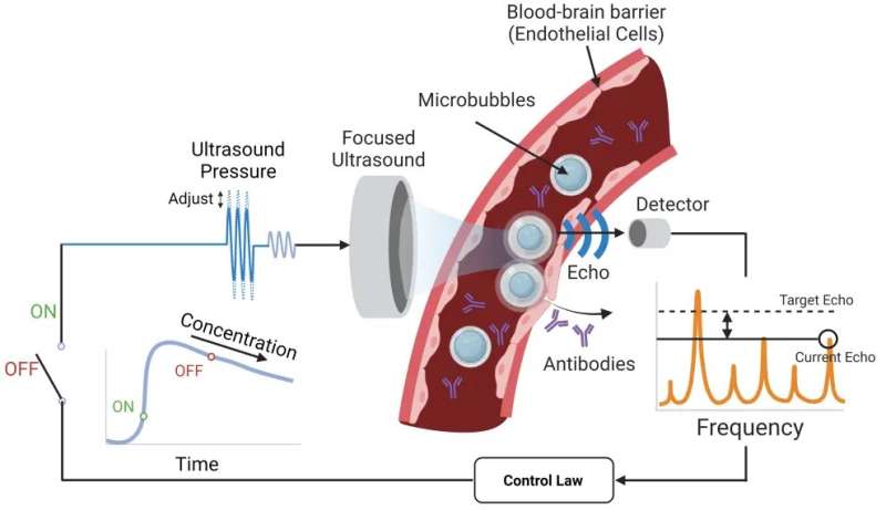 Closing the loop to target brain glioblastomas 