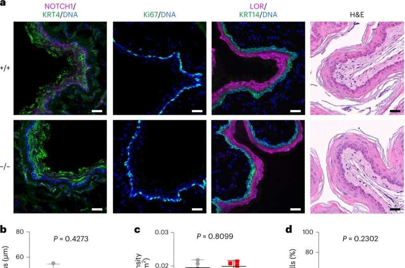 Protective mutation shown to impair esophagus tumor growth  