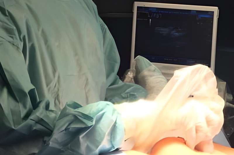 Ultrasound-guided surgery could be quicker, less painful and more effective for treating early form of breast cancer 