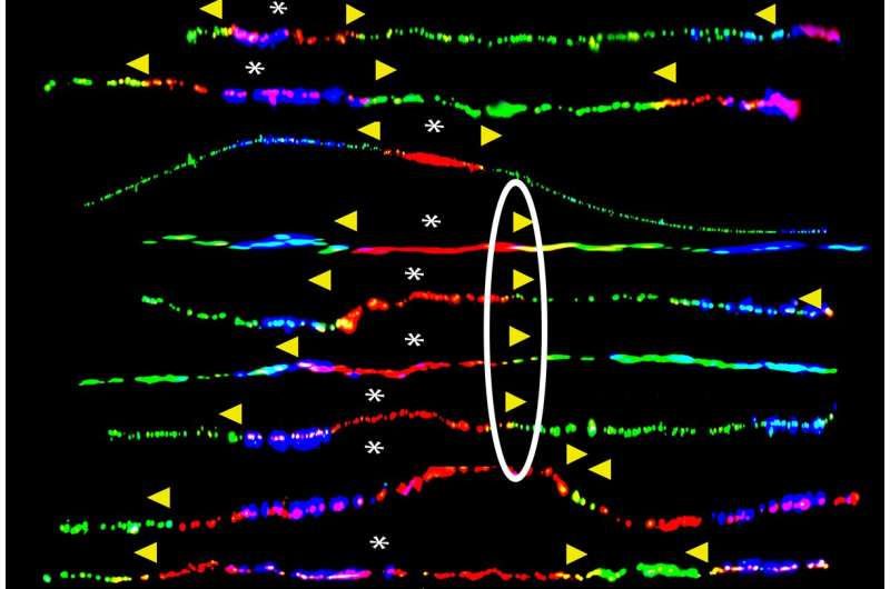 Faulty DNA repair may lead to BRCA-linked cancers 