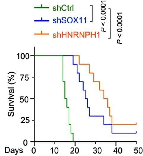 Single-cell 'atlas' reveals origin of an aggressive brain tumor