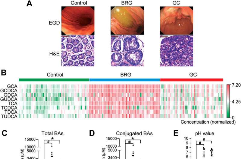 Salvia miltiorrhiza extract is a potential preventive agent for gastric cancer induced by bile reflux