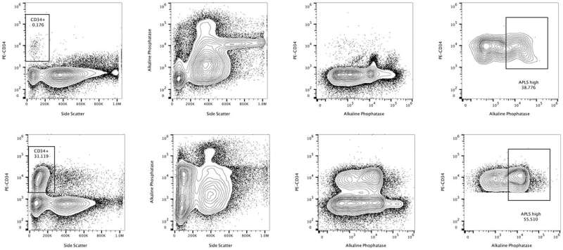 Closer to identifying leukemic stem cells