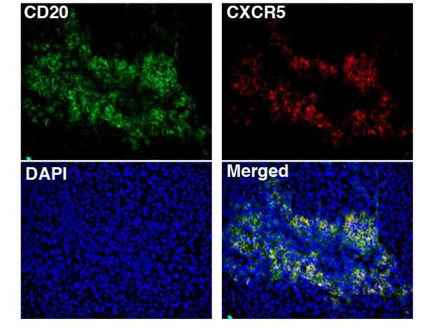 B cells linked to effective cancer immunotherapy