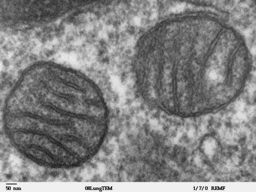 Protein transformation drives cancer development 