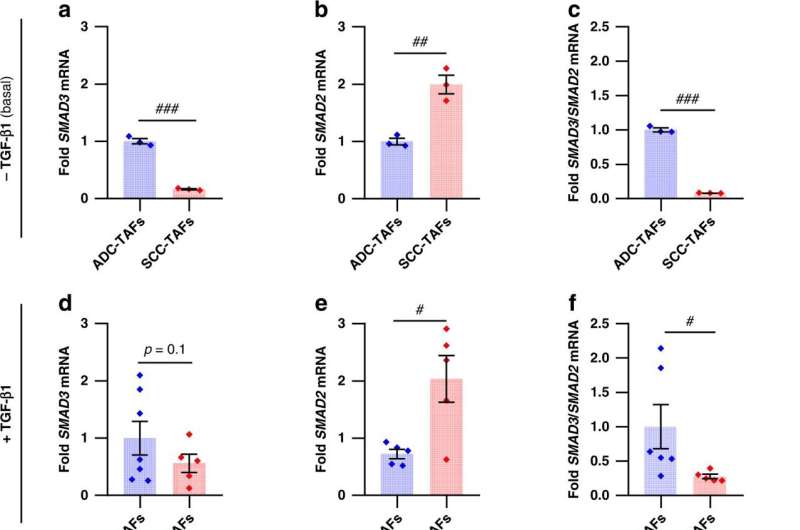 Mechanism discovered for cancer-associated fibroblasts in common lung cancer