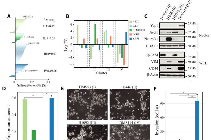 Novel cell 'switches' promote lung cancer growth, treatment resistance 