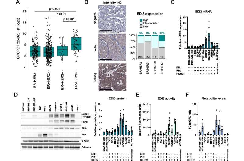 New potential therapeutic approach for HER2-positive breast cancer discovered 