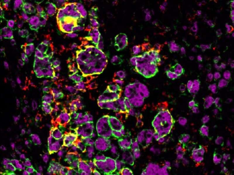 Testosterone is an ally of macrophages in the battle against adrenal cancers