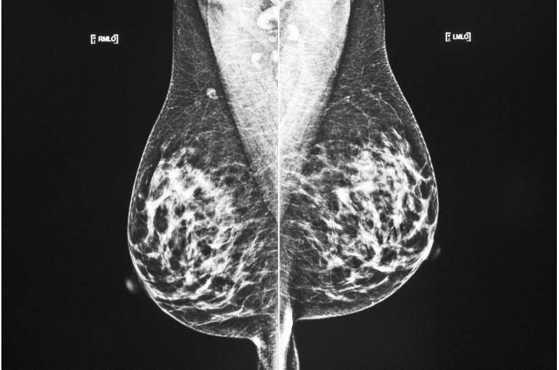 More breast cancer patients can choose smaller surgery