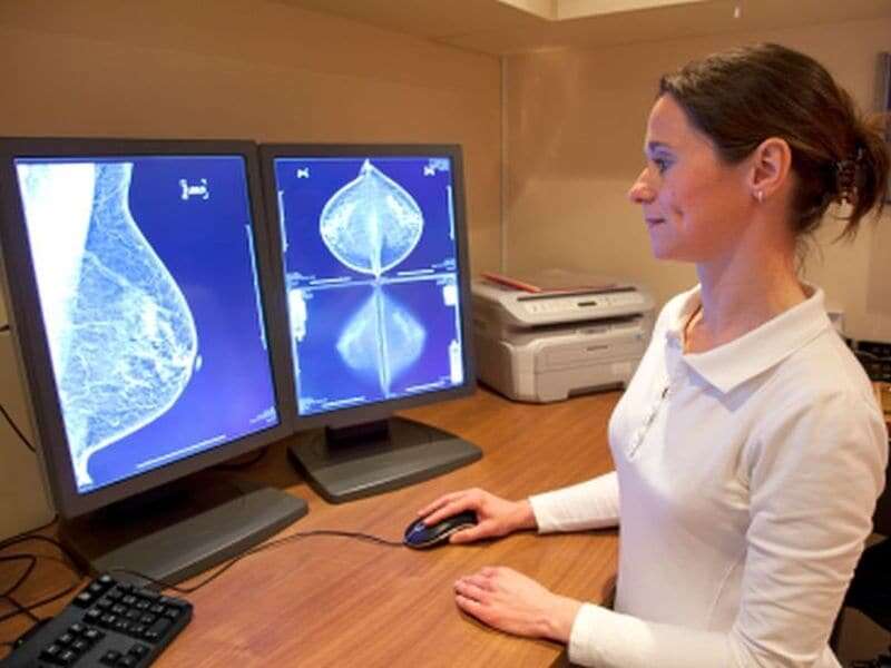 Radiotherapy for ductal in situ carcinoma ups mortality risk in invasive second breast cancer