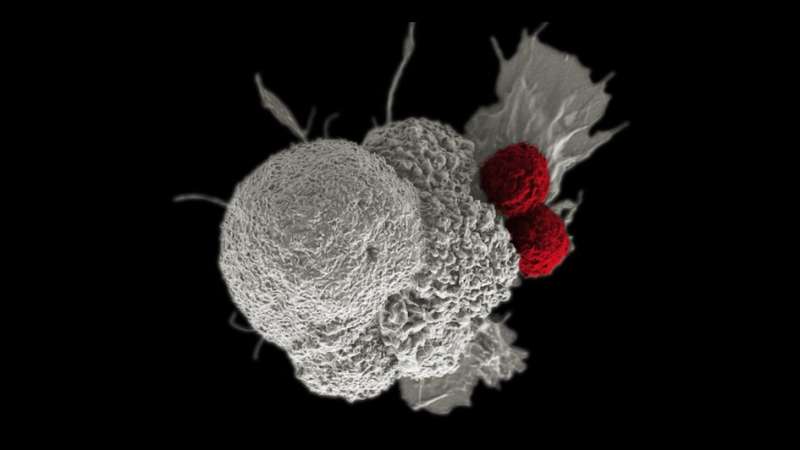 Deliberately damaging DNA could boost the effectiveness of immunotherapy in kidney cancer 