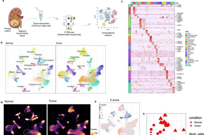 Gene signature points to prognosis in kidney cancer