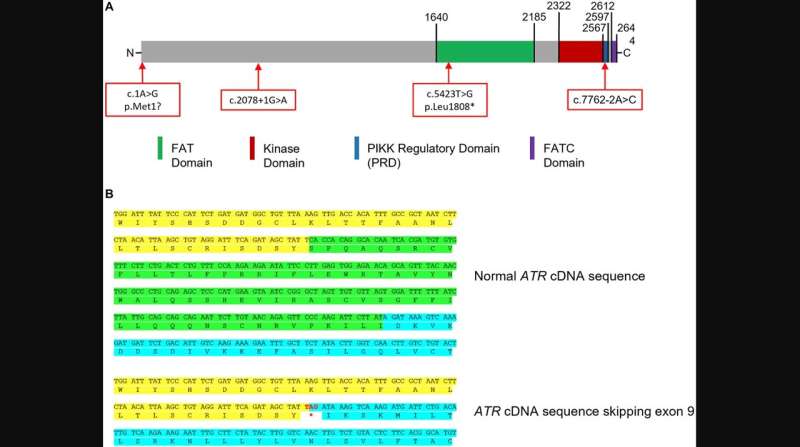 Extreme phenotype approach identifies rare ATR variants as potential male breast cancer susceptibility alleles 