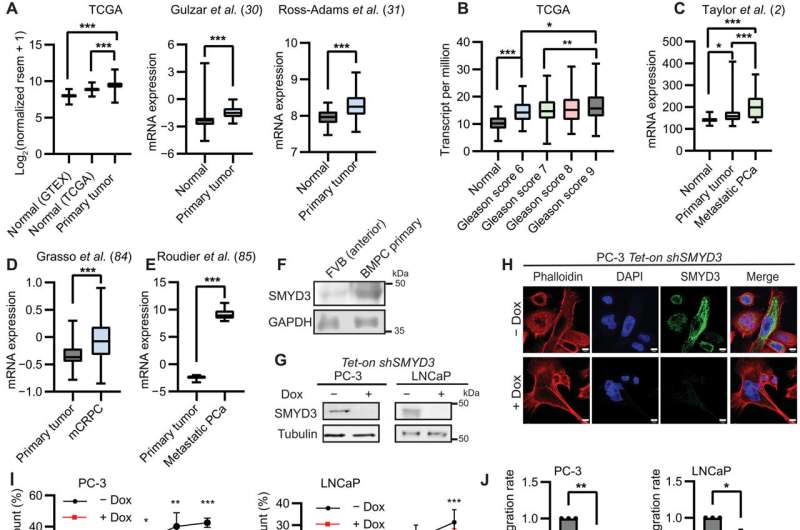 Researchers clarify role of SMYD3 enzyme in prostate cancer progression