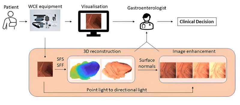 Capsule camera of the future can image intestines in 3D and detect disease