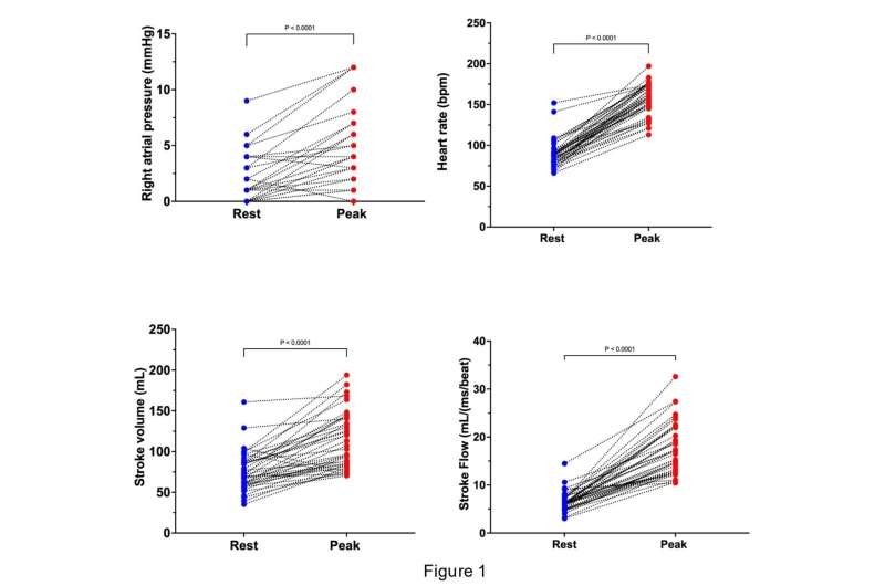 Study helps explain post-COVID exercise intolerance