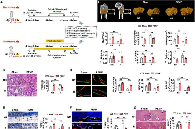 Pulsed electromagnetic field application technique for preventing bone loss due to radiotherapy