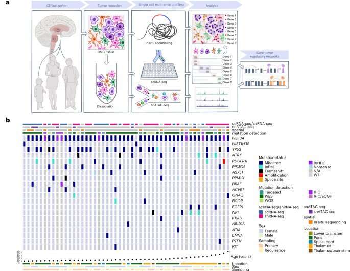 What does a diffuse midline glioma look like?