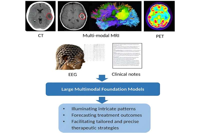 Artificial general intelligence for radiation oncology