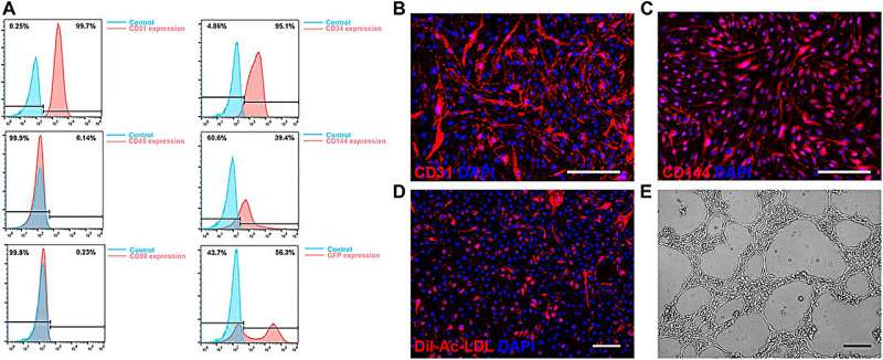 New bioengineered scaffold may help large deep burn wounds heal faster