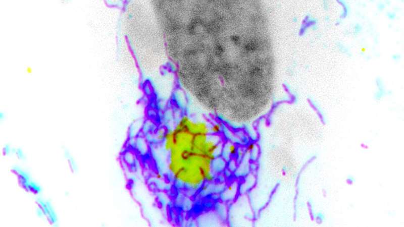 Exploring how poxviruses dismantle antiviral responses