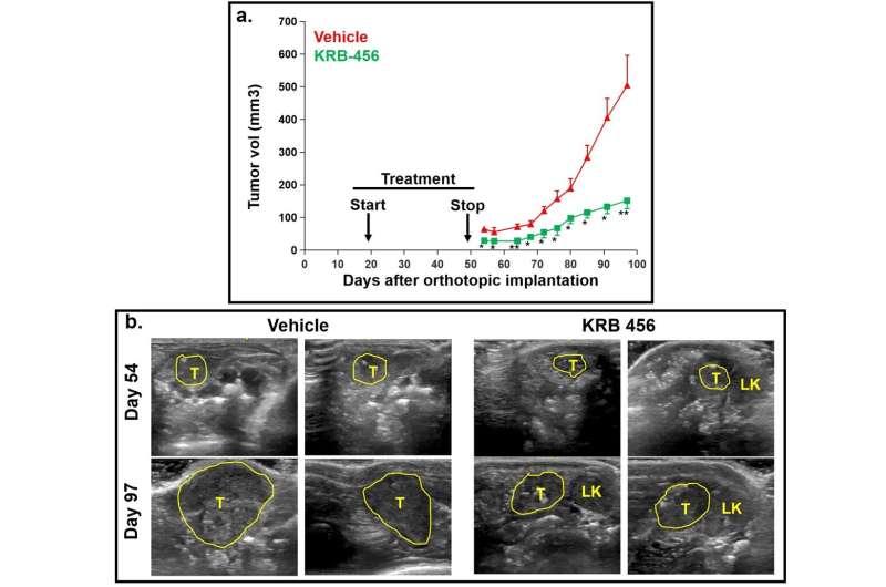 Groundbreaking discovery unveils promising anticancer drug targeting KRAS protein