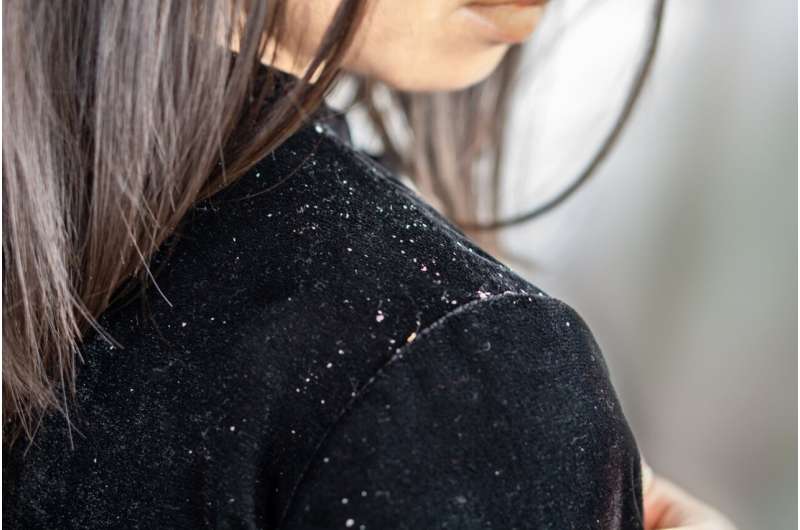 What is dandruff and how is it treated?