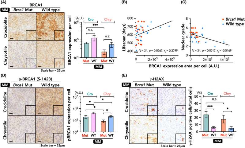 Those with the BRCA1 gene mutation may face greater risk for aggressive cancer caused by asbestos exposure