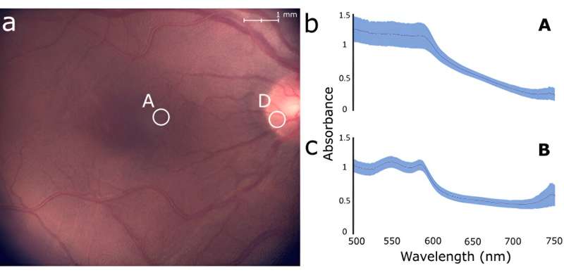 Scientists develop a versatile imaging system that will help diagnose pathologies in the back of the eye