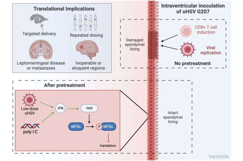 Oncotarget | Intraventricular immunovirotherapy; a translational step forward