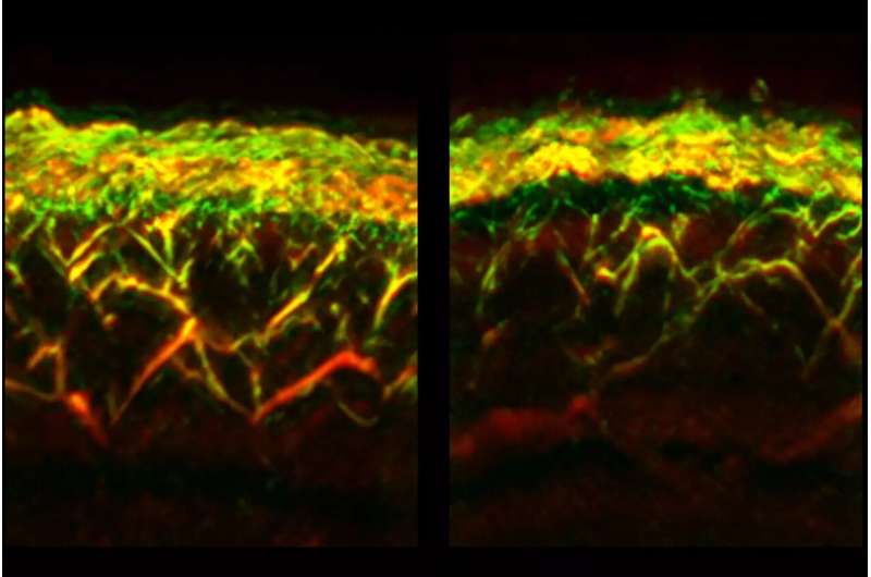 Examining diabetes with a skin scanner and AI