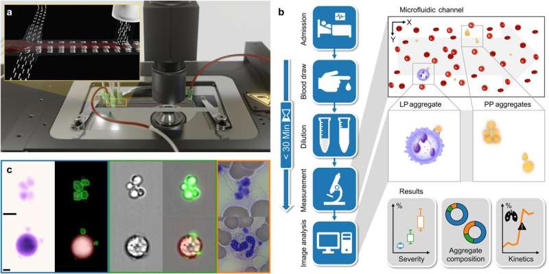 New method uses platelets to predict risk of serious COVID-19 infection