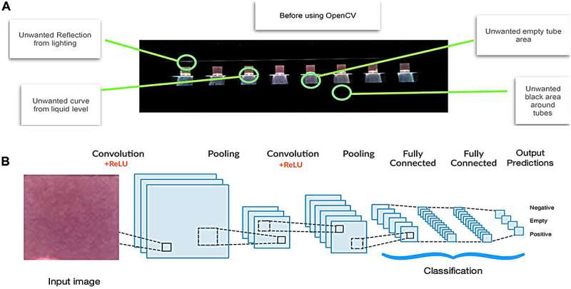 Artificial intelligence used in new COVID-19 test improves accuracy