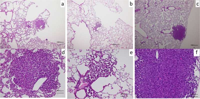 Actinidia arguta (sarunashi) juice found to inhibit lung cancer in mice