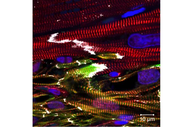 Combining cell types may lead to improved cardiac cell therapy following heart attack