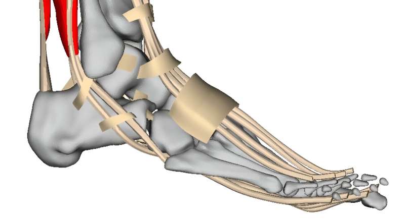 Tailor-made implants for patients thanks to simulations using virtual human modeling