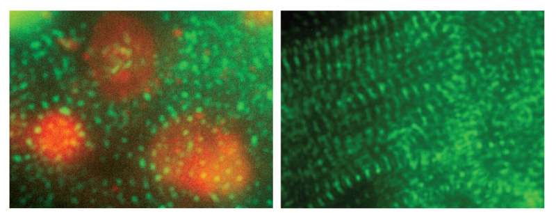 Stem cells used to target cancer treatment, protect heart cells